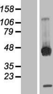 Western Blot: PPM1B Overexpression Lysate (Adult Normal) [NBP2-05005] Left-Empty vector transfected control cell lysate (HEK293 cell lysate); Right -Over-expression Lysate for PPM1B.