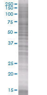 RBKS transfected lysate