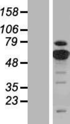 Western Blot: PKM2 Overexpression Lysate (Adult Normal) [NBP2-04864] Left-Empty vector transfected control cell lysate (HEK293 cell lysate); Right -Over-expression Lysate for PKM2.