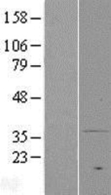 Western Blot: MPRA Overexpression Lysate (Adult Normal) [NBP2-04977] Left-Empty vector transfected control cell lysate (HEK293 cell lysate); Right -Over-expression Lysate for MPRA.