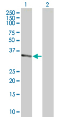 Lane 1: RBKS transfected lysate (35.53 KDa). Lane 2: Non-transfected lysate.