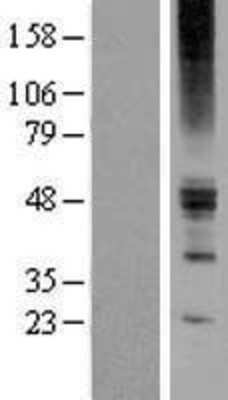 Western Blot: ZACN Overexpression Lysate (Adult Normal) [NBP2-04942] Left-Empty vector transfected control cell lysate (HEK293 cell lysate); Right -Over-expression Lysate for ZACN.