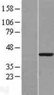 Western Blot: PPM1A Overexpression Lysate (Adult Normal) [NBP2-05002] Left-Empty vector transfected control cell lysate (HEK293 cell lysate); Right -Over-expression Lysate for PPM1A.