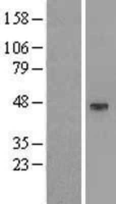 Western Blot: KCNK4 Overexpression Lysate (Adult Normal) [NBL1-12185] Left-Empty vector transfected control cell lysate (HEK293 cell lysate); Right -Over-expression Lysate for KCNK4.