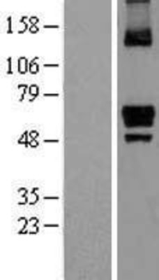 Western Blot: ITPRIP Overexpression Lysate (Adult Normal) [NBL1-12278] Left-Empty vector transfected control cell lysate (HEK293 cell lysate); Right -Over-expression Lysate for ITPRIP.