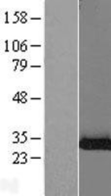 Western Blot: Shwachman Bodian-Diamond syndrome Overexpression Lysate (Adult Normal) [NBL1-15704] Left-Empty vector transfected control cell lysate (HEK293 cell lysate); Right -Over-expression Lysate for Shwachman Bodian-Diamond syndrome.