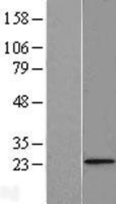 Western Blot: FUNDC2 Overexpression Lysate (Adult Normal) [NBL1-10859] Left-Empty vector transfected control cell lysate (HEK293 cell lysate); Right -Over-expression Lysate for FUNDC2.