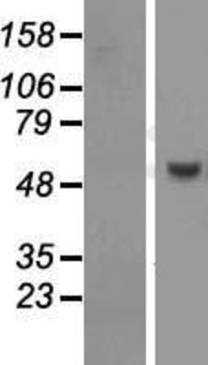 Western Blot: PUS10 Overexpression Lysate (Adult Normal) [NBL1-14998] Left-Empty vector transfected control cell lysate (HEK293 cell lysate); Right -Over-expression Lysate for PUS10.
