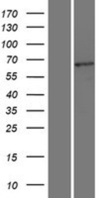 Western Blot: TCF7L2 Overexpression Lysate (Adult Normal) [NBL1-16777] Left-Empty vector transfected control cell lysate (HEK293 cell lysate); Right -Over-expression Lysate for TCF7L2.