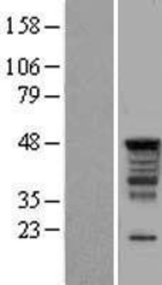 Western Blot: SERBP1 Overexpression Lysate (Adult Normal) [NBL1-15823] Left-Empty vector transfected control cell lysate (HEK293 cell lysate); Right -Over-expression Lysate for SERBP1.
