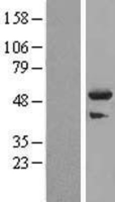 Western Blot: TRIM44 Overexpression Lysate (Adult Normal) [NBL1-17299] Left-Empty vector transfected control cell lysate (HEK293 cell lysate); Right -Over-expression Lysate for TRIM44.