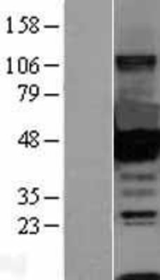 Western Blot: CtBP1 Overexpression Lysate (Adult Normal) [NBL1-09563] Left-Empty vector transfected control cell lysate (HEK293 cell lysate); Right -Over-expression Lysate for CtBP1.