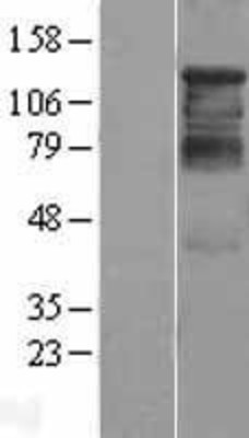 Western Blot: HDAC4 Overexpression Lysate (Adult Normal) [NBL1-11482] Left-Empty vector transfected control cell lysate (HEK293 cell lysate); Right -Over-expression Lysate for HDAC4.