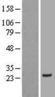 Western Blot: Annexin 2 Receptor Overexpression Lysate (Adult Normal) [NBL1-08496] Left-Empty vector transfected control cell lysate (HEK293 cell lysate); Right -Over-expression Lysate for Annexin 2 Receptor.