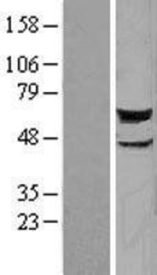 Western Blot: STK38 Overexpression Lysate (Adult Normal) [NBL1-16552] Left-Empty vector transfected control cell lysate (HEK293 cell lysate); Right -Over-expression Lysate for STK38.