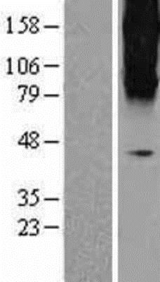 Western Blot: metabotropic Glutamate Receptor 3 Overexpression Lysate (Adult Normal) [NBL1-11348] - Left - Empty vector transfected control cell lysate (HEK293 cell lysate); Right - Over-expression Lysate for metabotropic Glutamate Receptor 3.