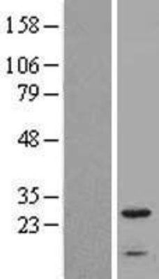 Western Blot: IFITM2 Overexpression Lysate (Adult Normal) [NBL1-11840] Left-Empty vector transfected control cell lysate (HEK293 cell lysate); Right -Over-expression Lysate for IFITM2.