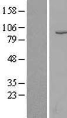Western Blot: CD10/Neprilysin Overexpression Lysate (Adult Normal) [NBL1-13148] Left-Empty vector transfected control cell lysate (HEK293 cell lysate); Right -Over-expression Lysate for CD10/Neprilysin.