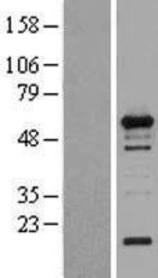 Western Blot: WIPF1/WIP Overexpression Lysate (Adult Normal) [NBL1-17852] Left-Empty vector transfected control cell lysate (HEK293 cell lysate); Right -Over-expression Lysate for WIPF1/WIP.