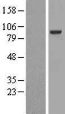 Western Blot: EML1 Overexpression Lysate (Adult Normal) [NBL1-10257] Left-Empty vector transfected control cell lysate (HEK293 cell lysate); Right -Over-expression Lysate for EML1.