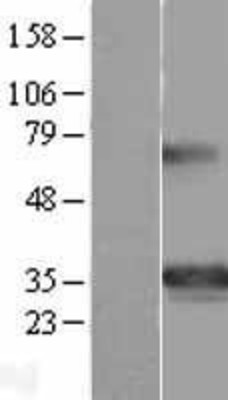 Western Blot: GSC Overexpression Lysate (Adult Normal) [NBL1-11357] Left-Empty vector transfected control cell lysate (HEK293 cell lysate); Right -Over-expression Lysate for GSC.