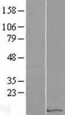 Western Blot: Eukaryotic translation initiation factor 1 Overexpression Lysate (Adult Normal) [NBL1-10169] Left-Empty vector transfected control cell lysate (HEK293 cell lysate); Right -Over-expression Lysate for Eukaryotic translation initiation factor 1.