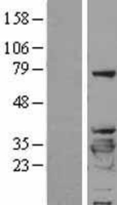 Western Blot: 14-3-3 beta/alpha Overexpression Lysate (Adult Normal) [NBL1-17946] Left-Empty vector transfected control cell lysate (HEK293 cell lysate); Right -Over-expression Lysate for 14-3-3 beta/alpha.