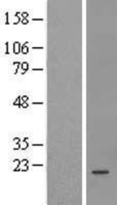 Western Blot: FAM204A Overexpression Lysate (Adult Normal) [NBL1-08088] Left-Empty vector transfected control cell lysate (HEK293 cell lysate); Right -Over-expression Lysate for FAM204A.