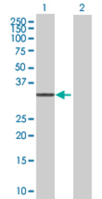Lane 1: PRPF40A transfected lysate (23.76 KDa) Lane 2: Non-transfected lysate.