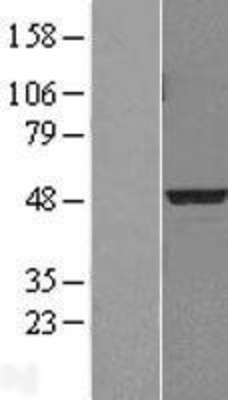 Western Blot: PDK3 Overexpression Lysate (Adult Normal) [NBL1-14251] Left-Empty vector transfected control cell lysate (HEK293 cell lysate); Right -Over-expression Lysate for PDK3.