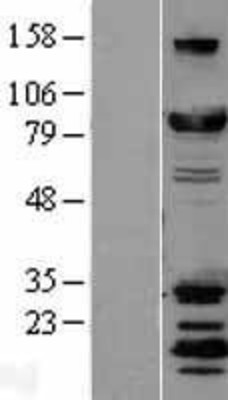 Western Blot: DRP1 Overexpression Lysate (Adult Normal) [NBL1-09966] Left-Empty vector transfected control cell lysate (HEK293 cell lysate); Right -Over-expression Lysate for DRP1.
