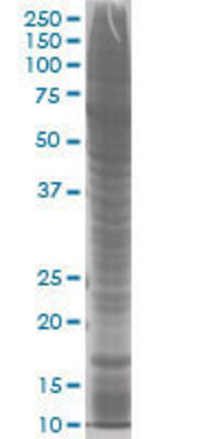 UBE2V1 transfected lysate
