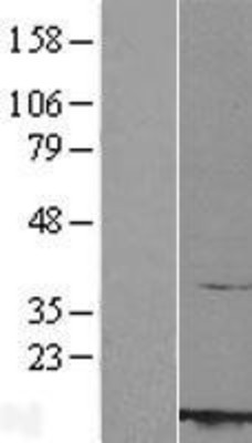 Western Blot: RBX1 Overexpression Lysate (Adult Normal) [NBL1-15236] Left-Empty vector transfected control cell lysate (HEK293 cell lysate); Right -Over-expression Lysate for RBX1.