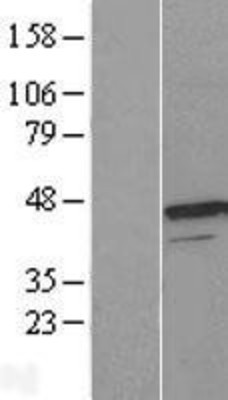 Western Blot: UROD Overexpression Lysate (Adult Normal) [NBL1-17634] Left-Empty vector transfected control cell lysate (HEK293 cell lysate); Right -Over-expression Lysate for UROD.