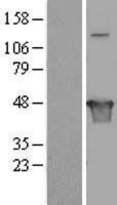 Western Blot: VAT1L Overexpression Lysate (Adult Normal) [NBL1-12269] Left-Empty vector transfected control cell lysate (HEK293 cell lysate); Right -Over-expression Lysate for VAT1L.