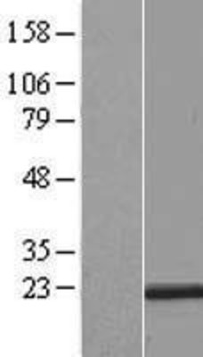 Western Blot: RER1 Overexpression Lysate (Adult Normal) [NBL1-15283] Left-Empty vector transfected control cell lysate (HEK293 cell lysate); Right -Over-expression Lysate for RER1.