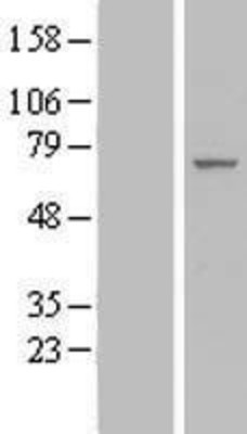 Western Blot: IF3EI Overexpression Lysate (Adult Normal) [NBL1-10193] Left-Empty vector transfected control cell lysate (HEK293 cell lysate); Right -Over-expression Lysate for IF3EI.