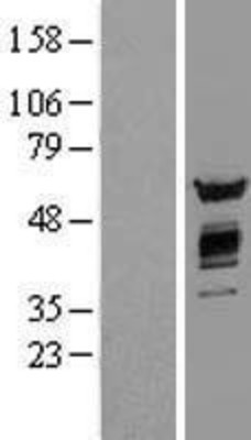 Western Blot: AKT2 Overexpression Lysate (Adult Normal) [NBL1-07442] Left-Empty vector transfected control cell lysate (HEK293 cell lysate); Right -Over-expression Lysate for AKT2.