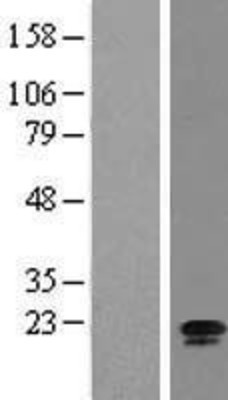Western Blot: RPL24/RLP24 Overexpression Lysate (Adult Normal) [NBL1-08198] Left-Empty vector transfected control cell lysate (HEK293 cell lysate); Right -Over-expression Lysate for RPL24/RLP24.