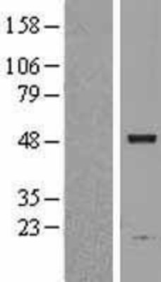 Western Blot: ASAH1 Overexpression Lysate (Adult Normal) [NBL1-07747] Left-Empty vector transfected control cell lysate (HEK293 cell lysate); Right -Over-expression Lysate for ASAH1.