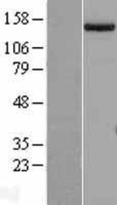 Western Blot: SETDB1 Overexpression Lysate (Adult Normal) [NBL1-15871] Left-Empty vector transfected control cell lysate (HEK293 cell lysate); Right -Over-expression Lysate for SETDB1.