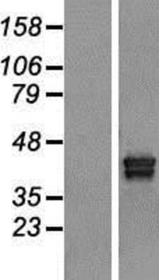 Western Blot: TXNDC5 Overexpression Lysate (Adult Normal) [NBL1-17472] Left-Empty vector transfected control cell lysate (HEK293 cell lysate); Right -Over-expression Lysate for TXNDC5.