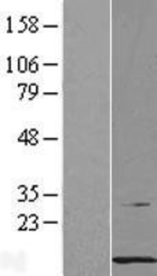 Western Blot: PCBD1 Overexpression Lysate (Adult Normal) [NBL1-14140] Left-Empty vector transfected control cell lysate (HEK293 cell lysate); Right -Over-expression Lysate for PCBD1.