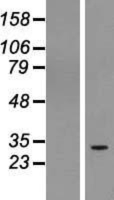 Western Blot: RUSC1 antisense RNA 1 Overexpression Lysate (Adult Normal) [NBL1-08289] Left-Empty vector transfected control cell lysate (HEK293 cell lysate); Right -Over-expression Lysate for RUSC1 antisense RNA 1.