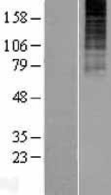 Western Blot: Neurokinin B Receptor Overexpression Lysate (Adult Normal) [NBP2-08339] Left-Empty vector transfected control cell lysate (HEK293 cell lysate); Right -Over-expression Lysate for Neurokinin B Receptor.