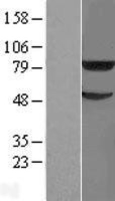 Western Blot: TRIM31 Overexpression Lysate (Adult Normal) [NBL1-17291] Left-Empty vector transfected control cell lysate (HEK293 cell lysate); Right -Over-expression Lysate for TRIM31.