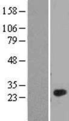 Western Blot: C1QL4 Overexpression Lysate (Adult Normal) [NBL1-08340] Left-Empty vector transfected control cell lysate (HEK293 cell lysate); Right -Over-expression Lysate for C1QL4.