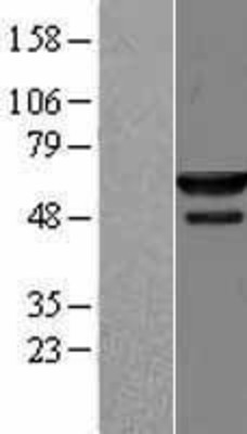 Western Blot: NMD3 Overexpression Lysate (Adult Normal) [NBL1-13681] Left-Empty vector transfected control cell lysate (HEK293 cell lysate); Right -Over-expression Lysate for NMD3.