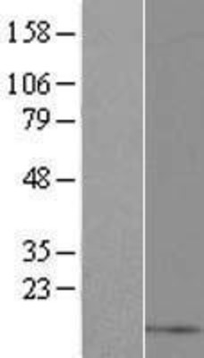 Western Blot: GNRH2 Overexpression Lysate (Adult Normal) [NBP2-08201] Left-Empty vector transfected control cell lysate (HEK293 cell lysate); Right -Over-expression Lysate for GNRH2.