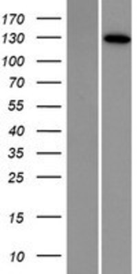 Western Blot: DNA2 Overexpression Lysate (Adult Normal) [NBP2-08334] Left-Empty vector transfected control cell lysate (HEK293 cell lysate); Right -Over-expression Lysate for DNA2.